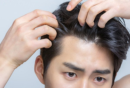 Updated approval details for hair loss products